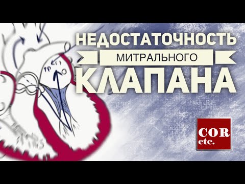 Недостаточность митрального клапана.