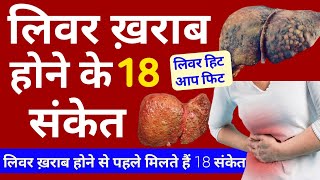 लिवर ख़राब होने के लक्षण | Liver Damage Hone Ke Symptoms | Liver Kharab Hone Ke Lakshan, Liver Sign