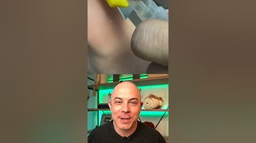 Doctor reacts to extremely satisfying and RIDICULOUS splinter removal! #dermreacts #doctorreacts