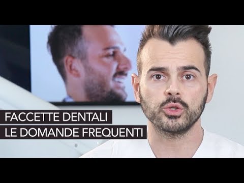 Video: Faccette Dentali: Pro E Contro