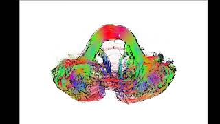 Enhancing bundle topology for tractography visualization using silhouette rendering