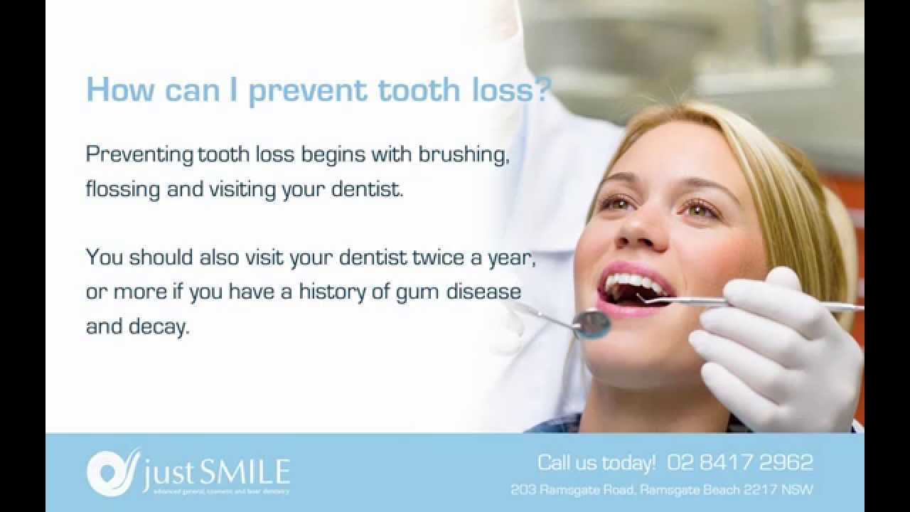 How to prevent tooth loss Sydney Dentist Dental implants YouTube
