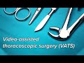 .assisted thoracoscopic surgery vats  pleural biopsy