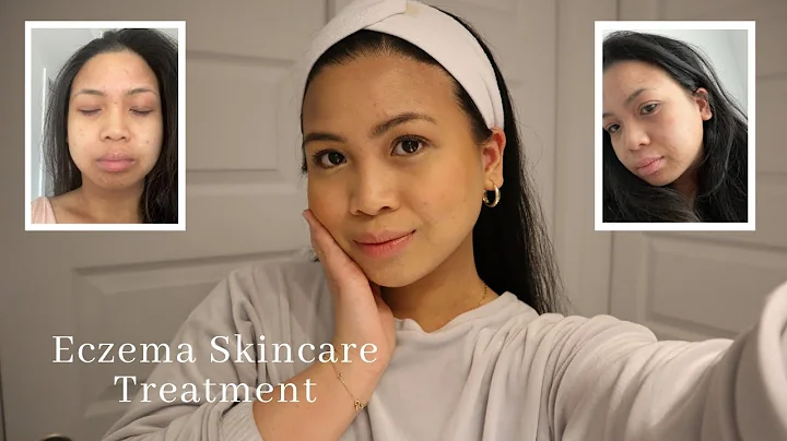 SKINCARE ROUTINE FOR DRY SENSITIVE SKIN | HOW TO H...