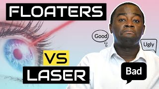 YAG laser treatment for eye floaters - Vitreolysis (The Good Bad &amp; Ugly)