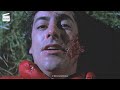 An American Werewolf in London: The bite