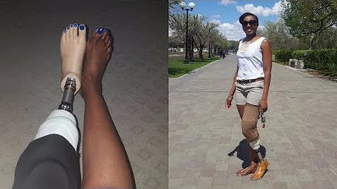 Regina woman shocked to discover lack of colour op...