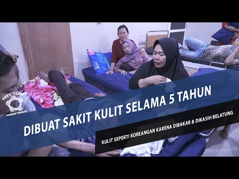 Video: Orang Cantik Jarang Terdiagnosis Berbagai Penyakit - Pandangan Alternatif