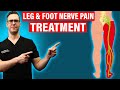 Peripheral neuropathy home remedies leg  foot nerve pain treatment