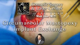 Cirareolar Mastopexy Implant Exchange Dr. Mark Jabor