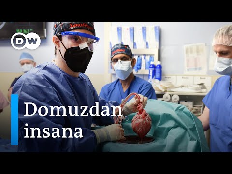 Domuzdan insana ilk kalp nakli | “Organları hazır halde bulundurmamız çığır açıcı olur”- DW Türkçe