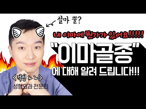 이마에 자라나는 "이마골종"에 대해 닥터첫번째가 알려드립니다. 👨‍⚕️본격!!! 골종제거수술시뮬레이션