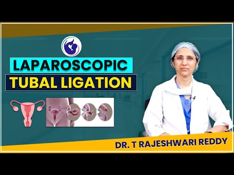 Laparoscopic Tubal Ligation | Dr. T Rajeshwari Reddy Explains