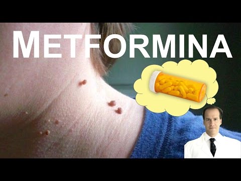 metformina precio Metformina para las verrugas en el cuello