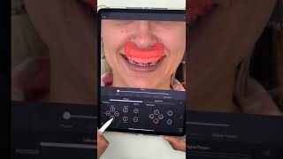 Dental Talk: Create smile designs with more precision using IO scans screenshot 2