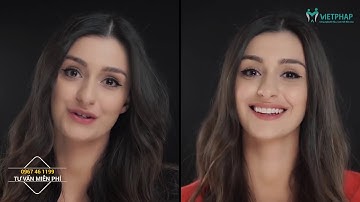 Công nghệ thiết kế nụ cười - Digital Smile Design