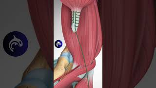 What happens if your Distal Biceps ruptures? #biceps #3d #health