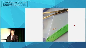 CVI2018 Session: Perforation during CTO PCI - Tony Spaedy, MD