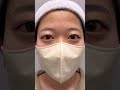 【二重整形/ASMR】この方二重整形する必要ある!?#shorts