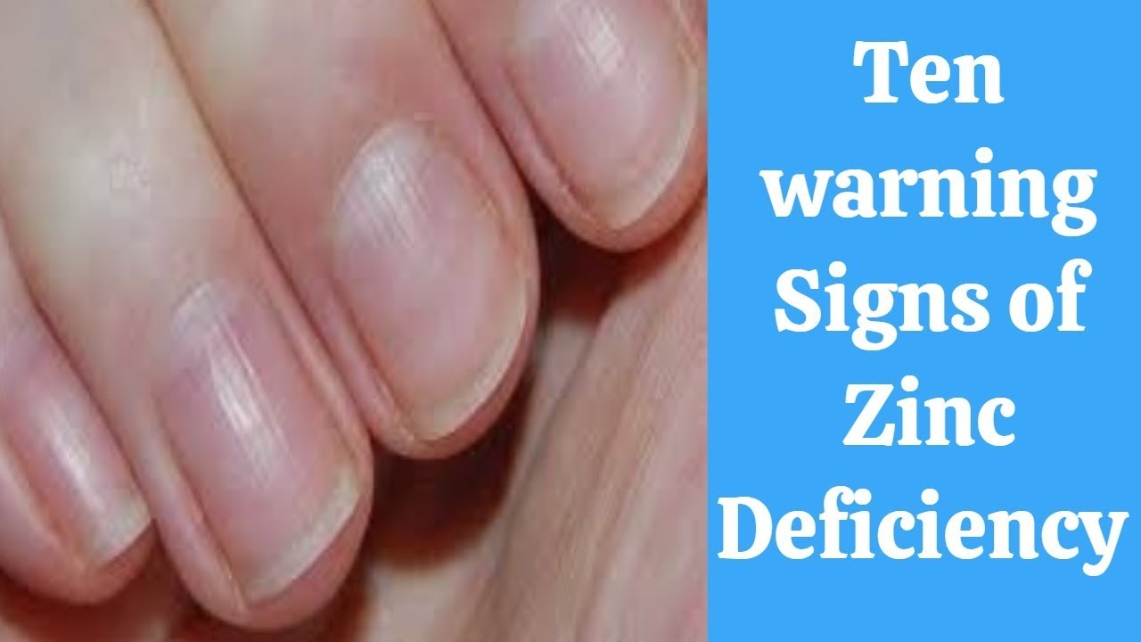 Warning Signs Of Zinc Deficiency And How To Treat It Youtube