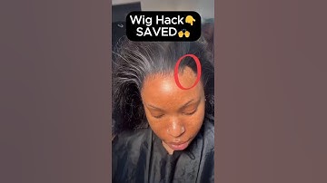 How to fix the bald spot on head😜#wigs #wigstyling #wigtutorial #hair #shorts #short #lacewigs