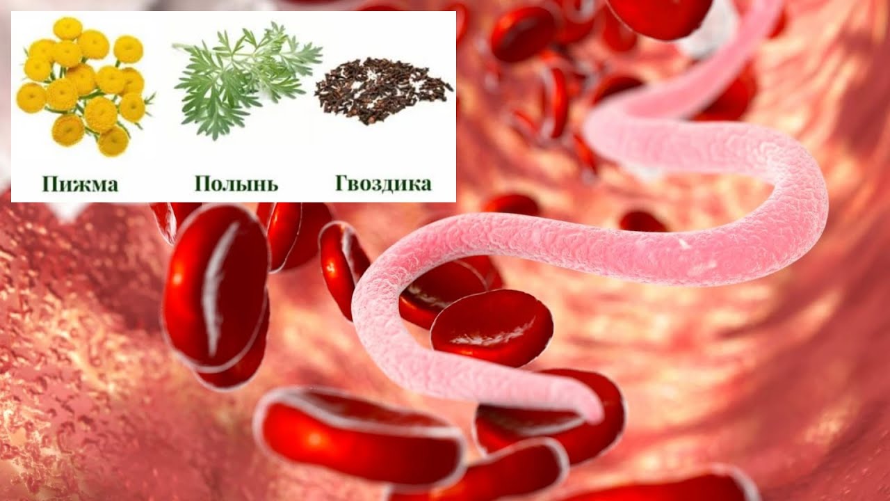 Очистки организма от паразитов. Очищение организма от паразитов. Очищение от паразитов и глистов. Чистка организма от глистов. Очищение организма от глистов и паразитов.