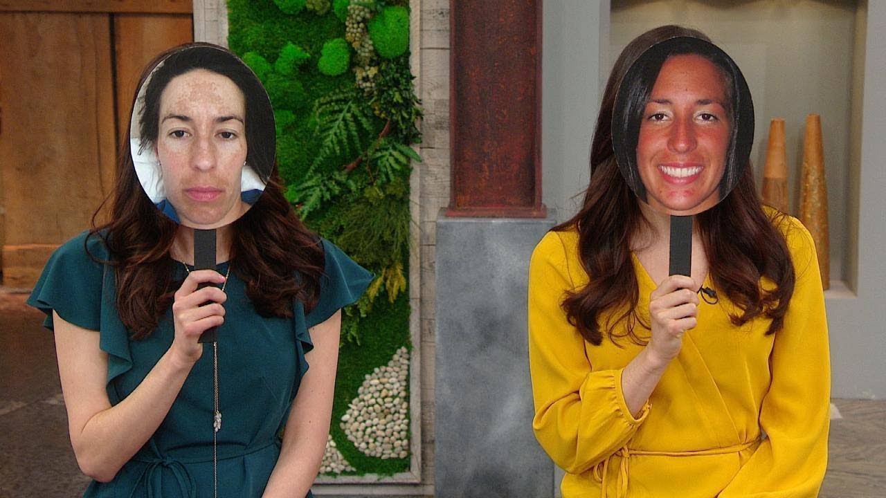 These Identical Twins Tried Probiotic Skincare For 3 Weeks -- And You Won't Believe The Results!