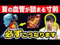 『首』の血管が詰まる直前にだけ出る危険サイン、必ずこうなります。【なぜ報道しない？】現役医師が頸動脈狭窄症を簡単に解説します。