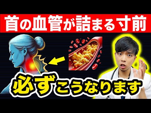 『首』の血管が詰まる直前にだけ出る危険サイン、必ずこうなります。【なぜ報道しない？】現役医師が頸動脈狭窄症を簡単に解説します。