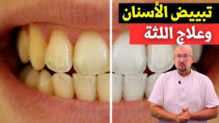 تبييض الأسنان وعلاج اللثة وصفات الدكتور عماد ميزاب Docteur Imad Mizab