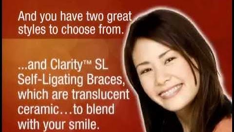 Mắc cài tự buộc (self-ligating braces 3M)