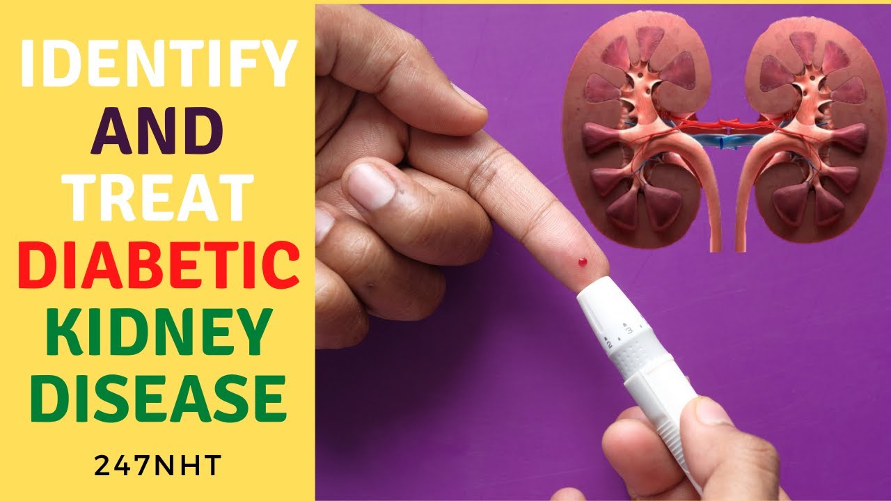 Identify And Treat Diabetic Kidney Disease Can You Reverse Kidney identify-and-treat-diabetic-kidney-disease-can-you-reverse-kidney