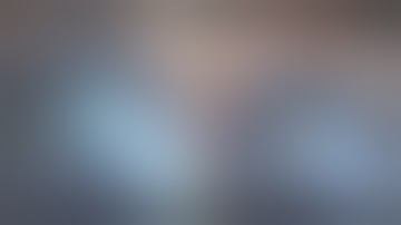 The Technique of "direct chop" in three different grades of cataract