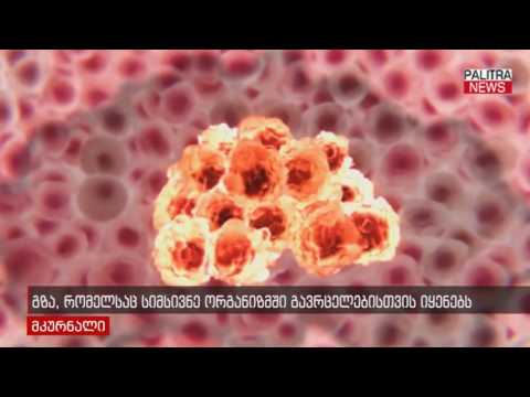 გზა, რომელსაც სიმსივნე ორგანიზმში გავცელებისთვის იყენებს