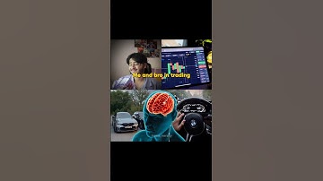 Link in bio 🥱💸 #binaryoptions #trading #shorts