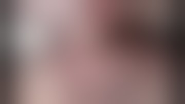 Robotic-assisted surgical endoscopy: a new era for endoluminal therapies