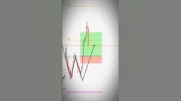 📈DOUBLE BOTTOM PATTERN STRATEGY || IN XAUUSD GOLD #shorts #interdaytrading