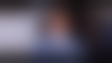 TKA Extensor Mechanism Reconstruction Allograft