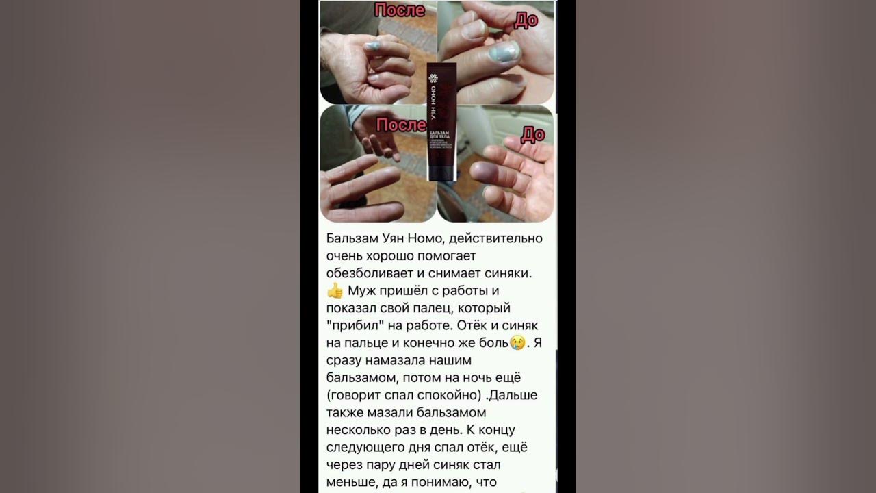 отлично помогает при ушибах и синяках 👍 - YouTube