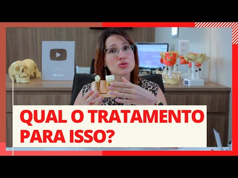 Vídeo: Dentes fraturados podem curar?