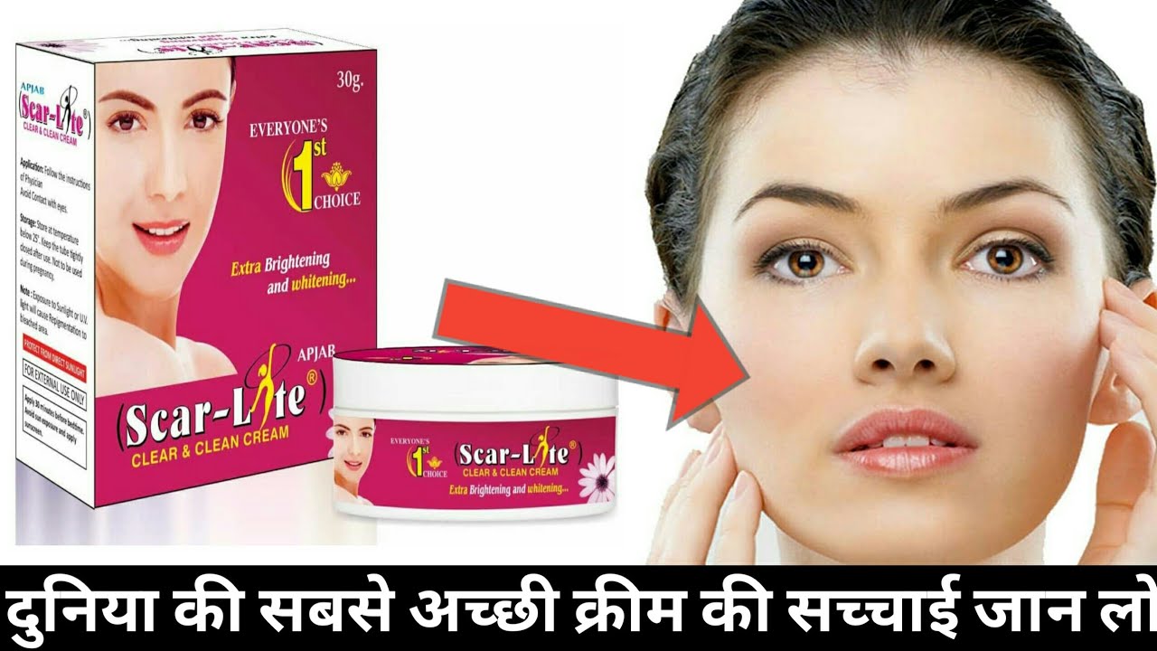 Scar Lite Cream scar lite cream review in hindi skin lite cream use