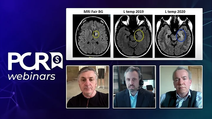 Ground-breaking 5-year outcomes from the REDUCE clinical study - Webinar