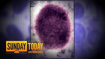 Monkeypox Now A Public Health Emergency: How To Stay Safe