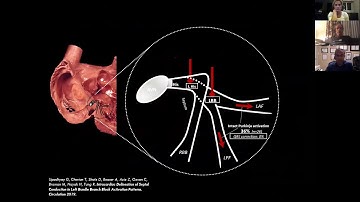 Left Bundle Branch Pacing Webinar