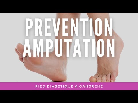 Vidéo: Traitement De La Gangrène Sans Amputation