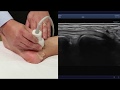 Imaging the ankle using the aplio i800ultrasound