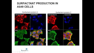 Air Liquid Interphase Exposure of In Vitro Models for Alveolar Toxicity