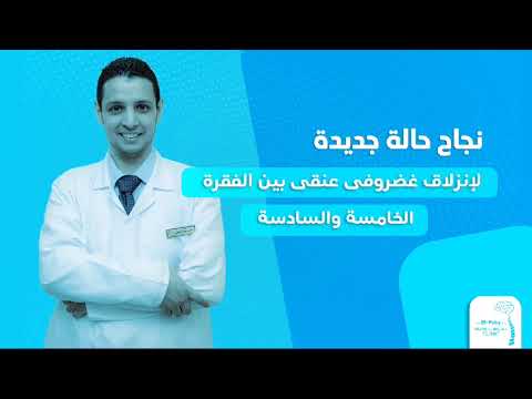 عمل استئصال للغضروف وتركيب قفص كربوني على يد الدكتور محمود جمال الفقي استشاري جراحات المخ والاعصاب