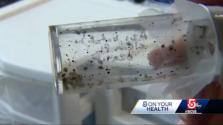 Experts warn of risk of infection during tick season