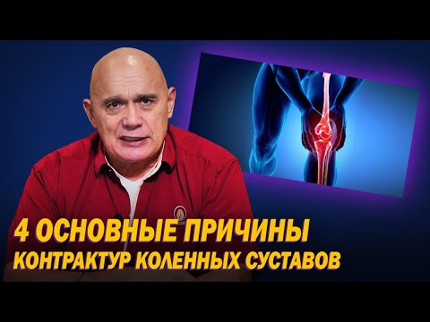 Как вернуть подвижность коленям без операции? Профилактика и лечение контрактур коленного сустава